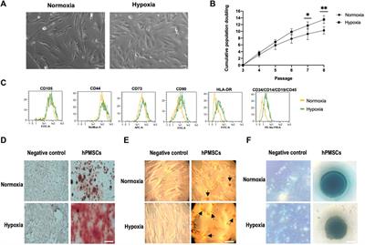 Human placenta-derived mesenchymal stem cells stimulate neuronal regeneration by promoting axon growth and restoring neuronal activity